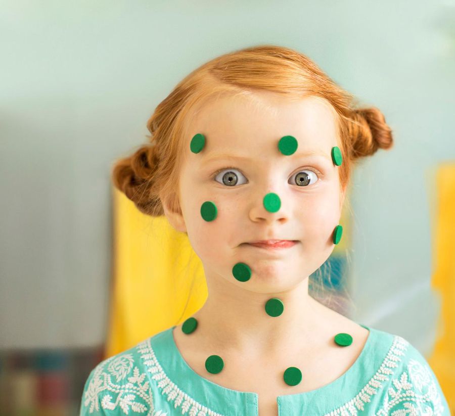 Girl With Green Sticker Chicken Pox